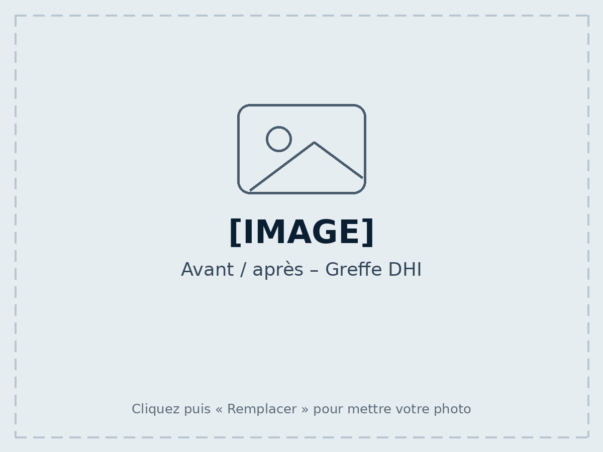 Avant / après – Greffe DHI