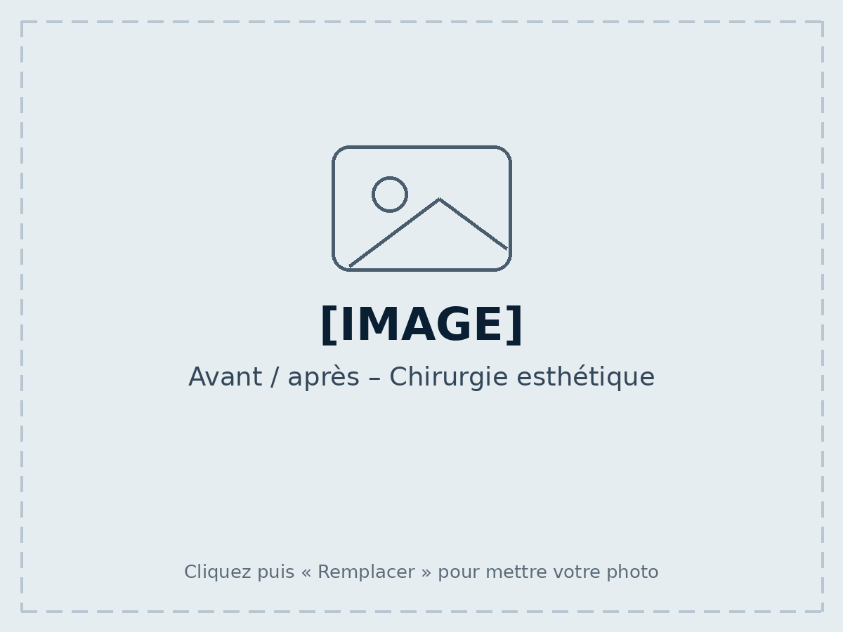 Avant / après – Chirurgie esthétique